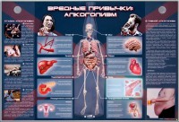 Электрифицированный стенд "Вредные привычки: алкоголизм" - fgospostavki.ru - Верхняя Пышма