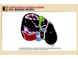 Рельефная таблица "Печень. Висцеральная поверхность" (формат А1, матовое ламинирование) - fgospostavki.ru - Верхняя Пышма