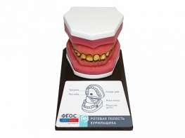 Демонстрационная модель "Ротовая полость курильщика" - fgospostavki.ru - Верхняя Пышма
